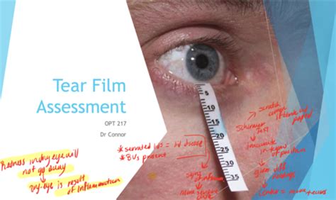 tear film assessment tests|tear film analysis.